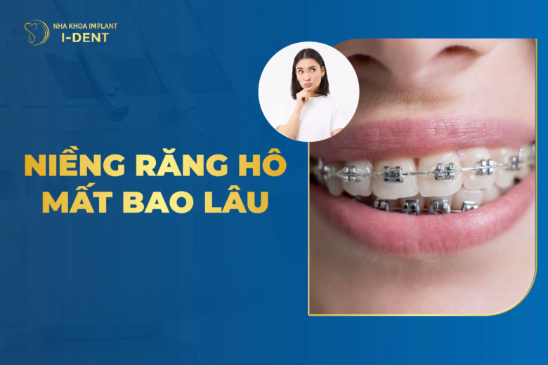 niềng răng hô mất lao lâu