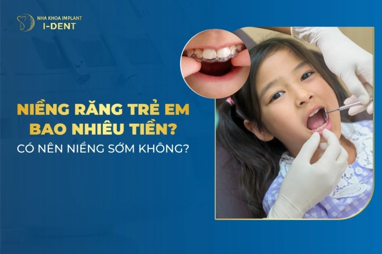 Niềng răng trẻ em
