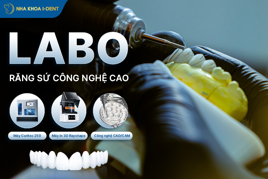 răng thẩm mỹ