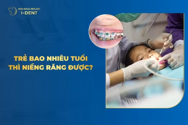Độ Tuổi Niềng Răng Cho Trẻ Phù Hợp Là Khi Nào? Có Nên Niềng Sớm?