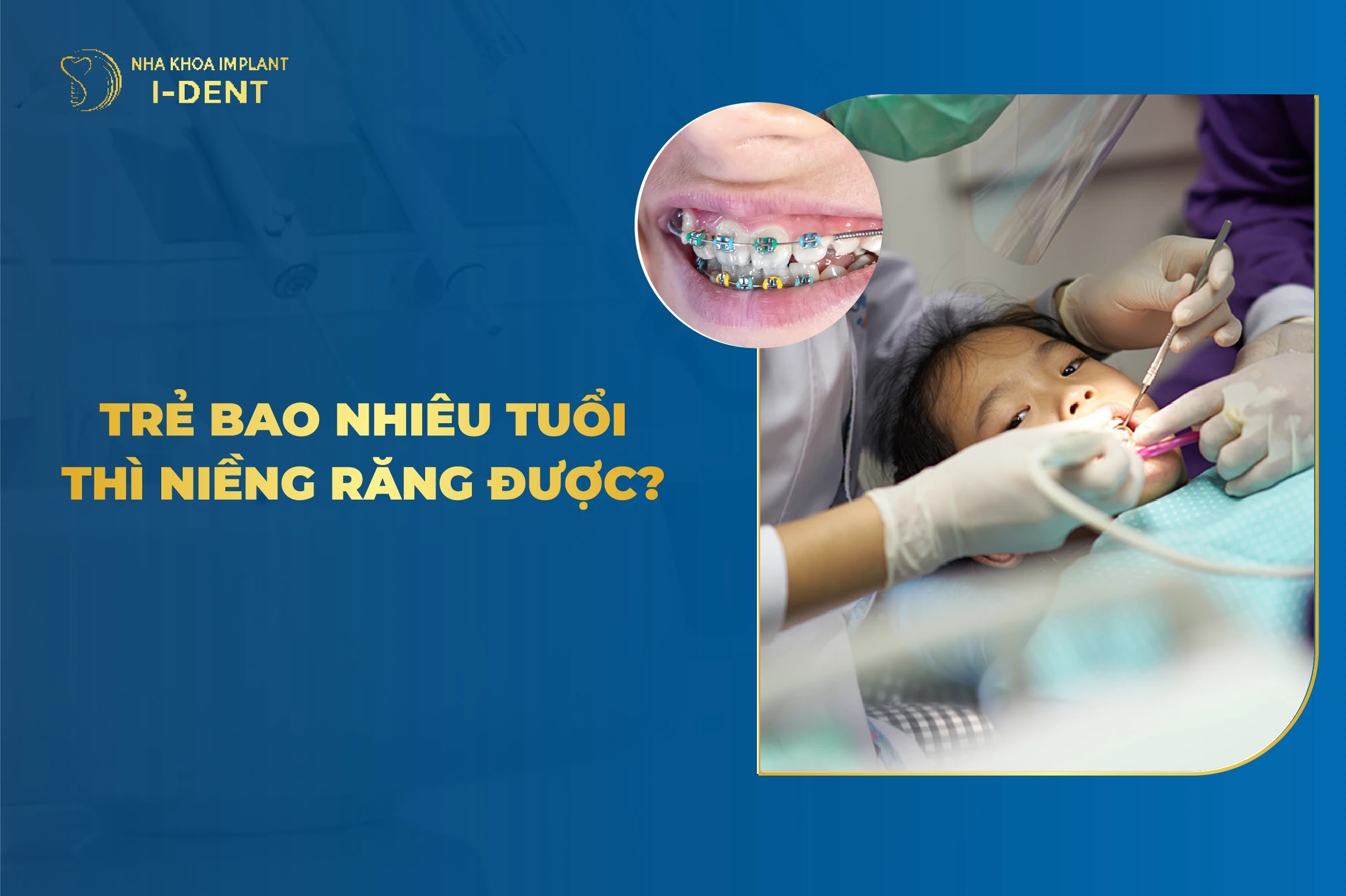 Khi Nào Nên Niềng Răng Cho Trẻ? Độ Tuổi Nào Phù Hợp?