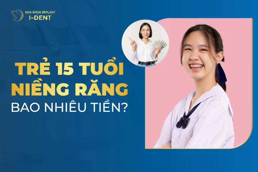 15-tuoi-nieng-rang-bao-nhieu-tien