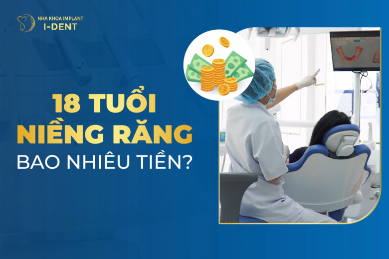 18 tuổi niềng răng bao nhiêu tiền