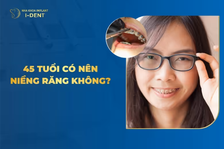 45 có nên niềng răng