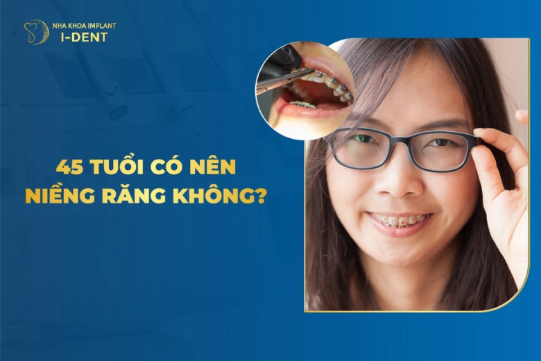 45 Tuổi Có Nên Niềng Răng? Có Hiệu Quả Không?