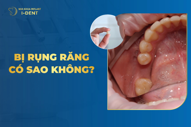 bị rụng răng có sao không