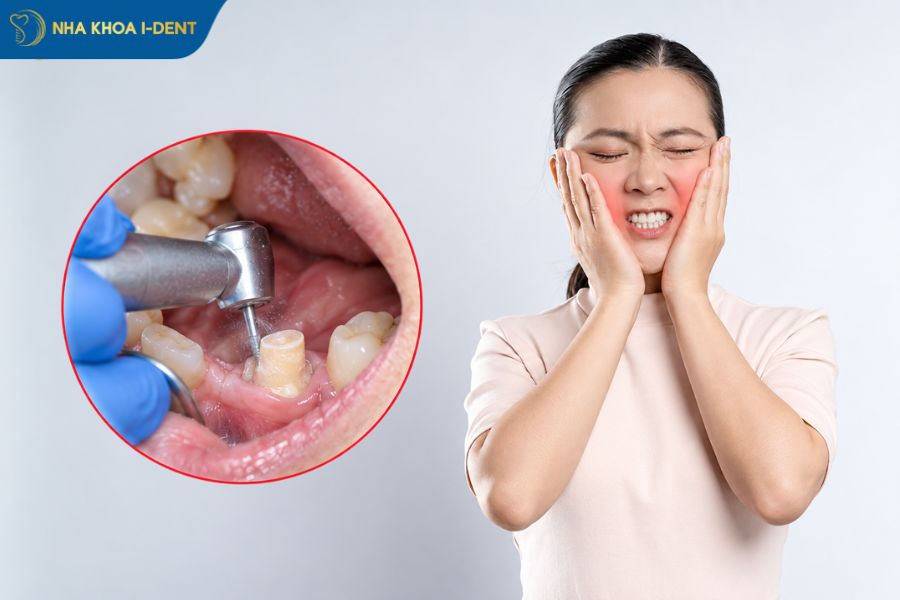 bọc răng sứ thẩm mỹ là gì