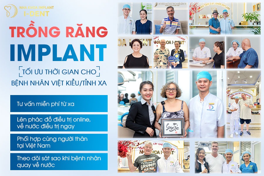 bảng giá implant