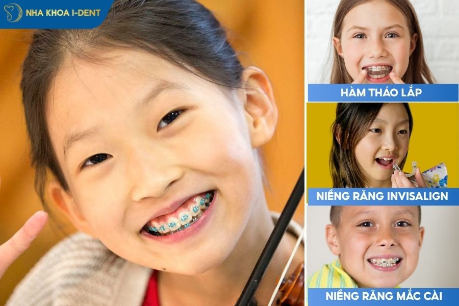 chi phí niềng răng cho trẻ em