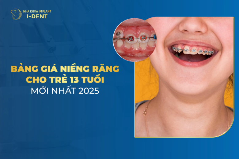 giá niềng răng cho trẻ 13 tuổi