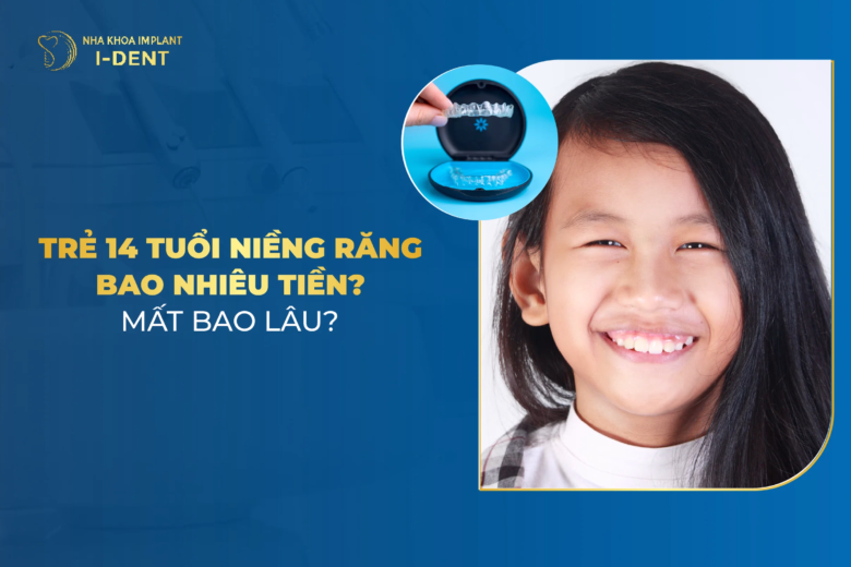 giá niềng răng cho trẻ 14 tuổi