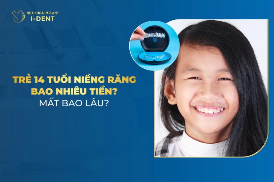 Trẻ 14 tuổi niềng răng bao nhiêu tiền? Bảng giá chi tiết 2026