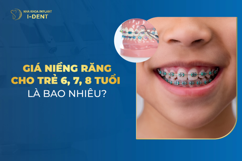 niềng răng cho trẻ 7 tuổi giá bao nhiêu