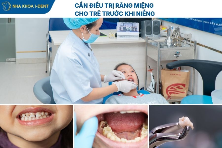 chi phí niềng răng cho trẻ em