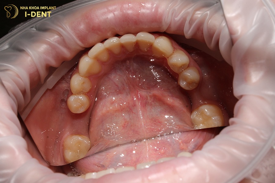 Khám răng định kỳ để phát hiện sớm các bệnh lý răng miệng.