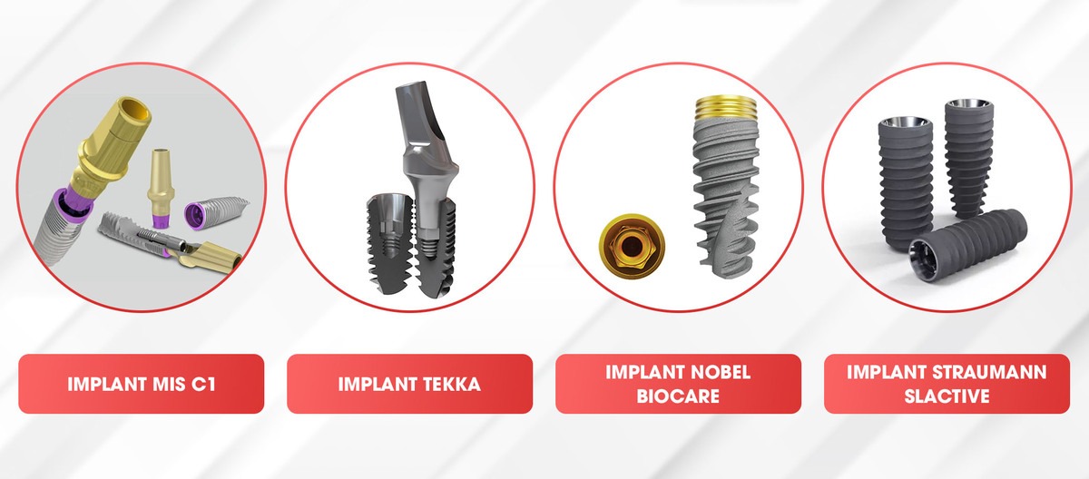Các loại trụ cấy ghép implant toàn hàm