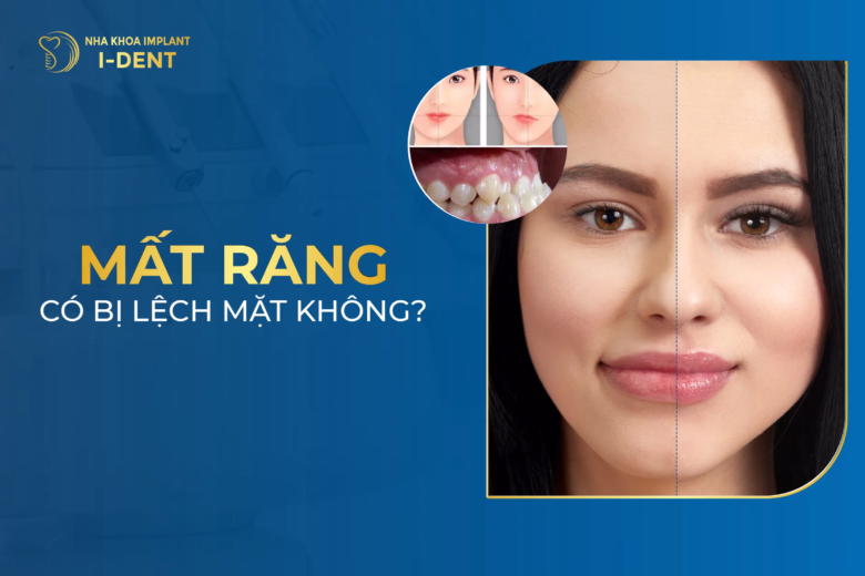 bị mất răng có bị mặt lệch không