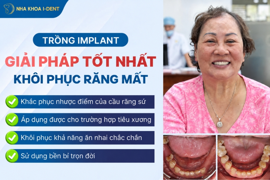 mất răng mặt có bị lệch không