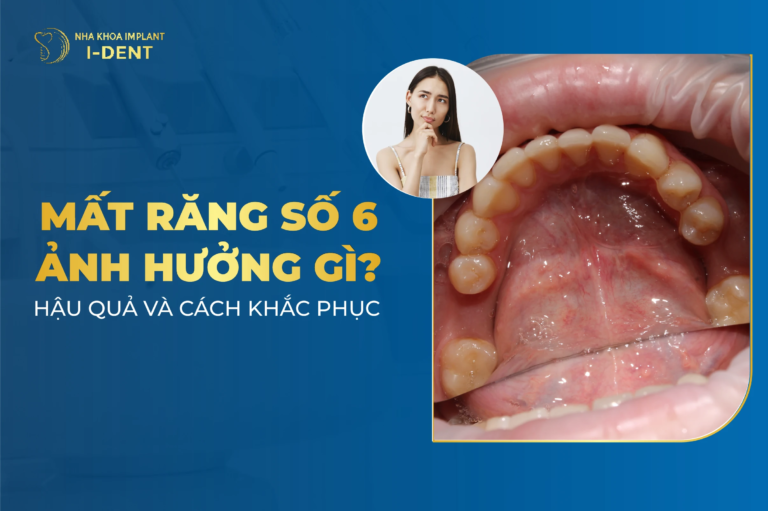 hau qua cua mat rang so 6 som va cach khac phuc