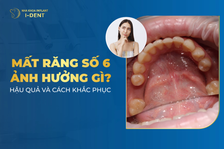 hau qua cua mat rang so 6 som va cach khac phuc