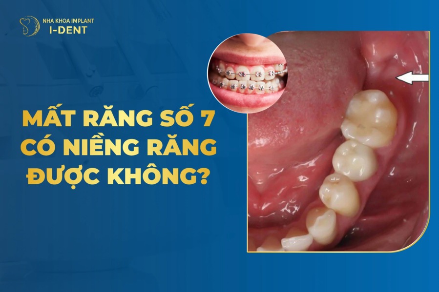 Mất Răng Số 7 Có Niềng Răng Được Không?