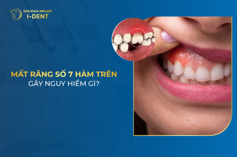 mất răng số 7 hàm trên nguy hiểm như thế nào