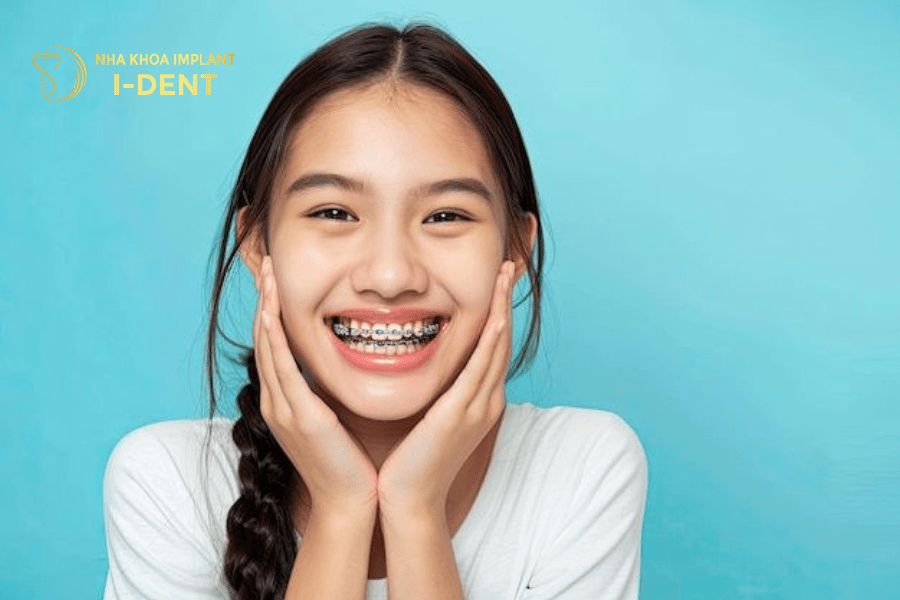 nên niềng răng cho trẻ 14 tuổi sớm
