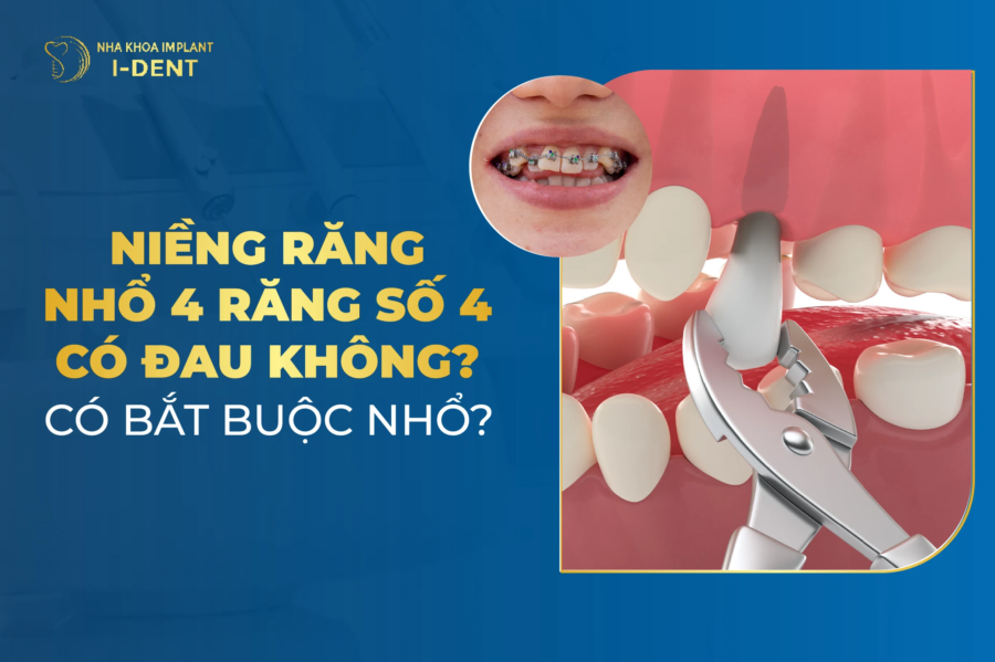 Có nên nhổ răng số 4 để niềng răng không? Có gây đau không?