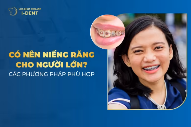 niềng răng cho người lớn