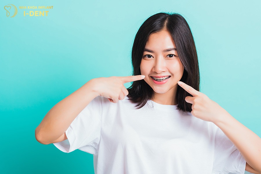 niềng răng chữa cười hở lợi