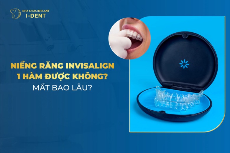 Niềng Răng Invisalign 1 Hàm Được Không? Mất Bao Lâu?