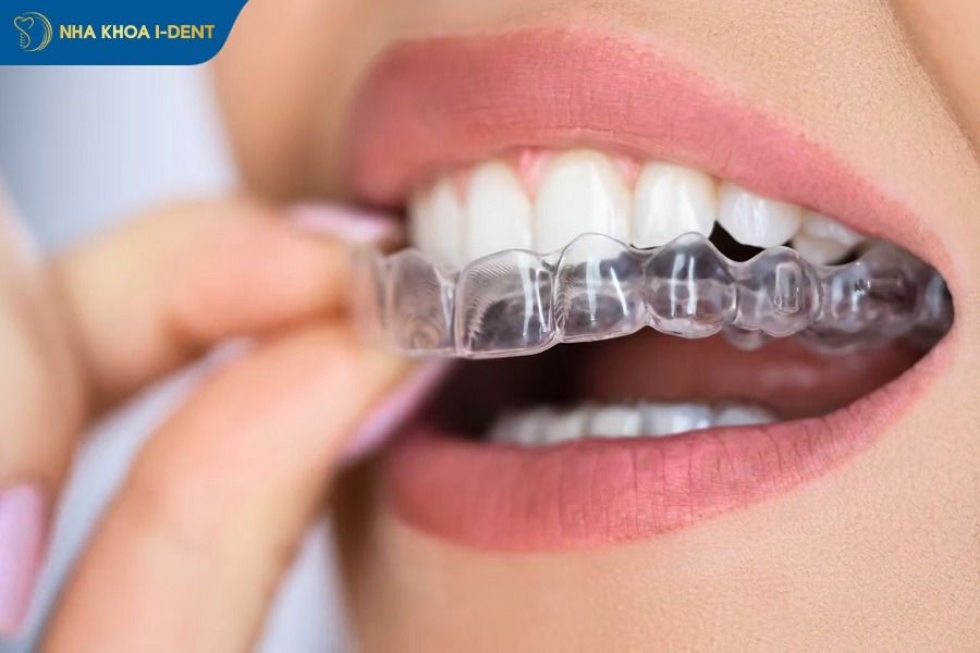 niềng răng invisalign