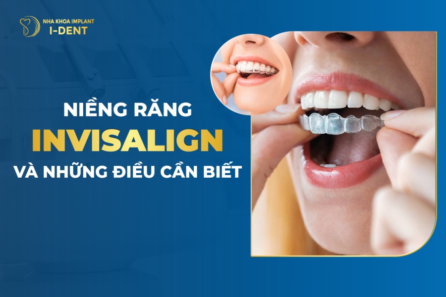 Niềng Răng Invisalign Là Gì? Bảng Giá, Ưu Điểm Và Quy Trình