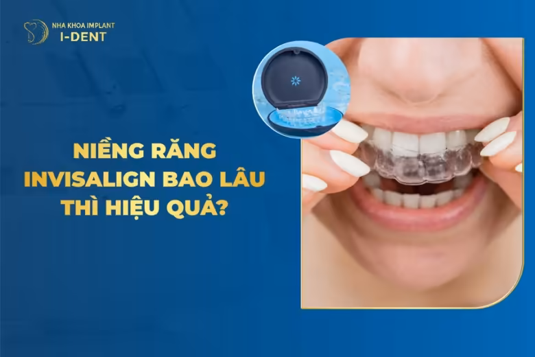 niềng răng invisalign mất bao lâu