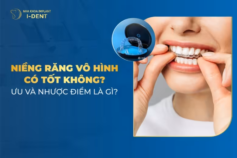 niềng răng vô hình