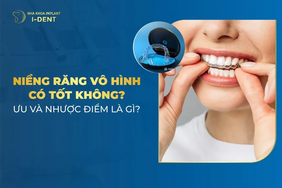 niềng răng vô hình