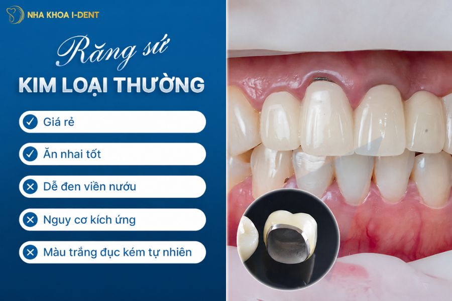tác dụng của bọc răng sứ