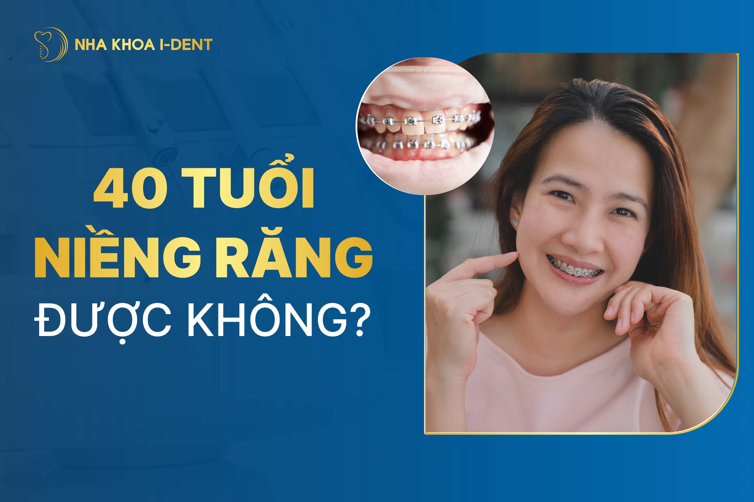40 tuổi niềng răng được không? Bao nhiêu tiền?