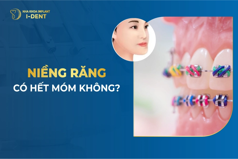 Bị móm có nên niềng răng? Niềng răng có hết móm?