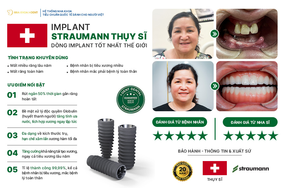 các loại implant