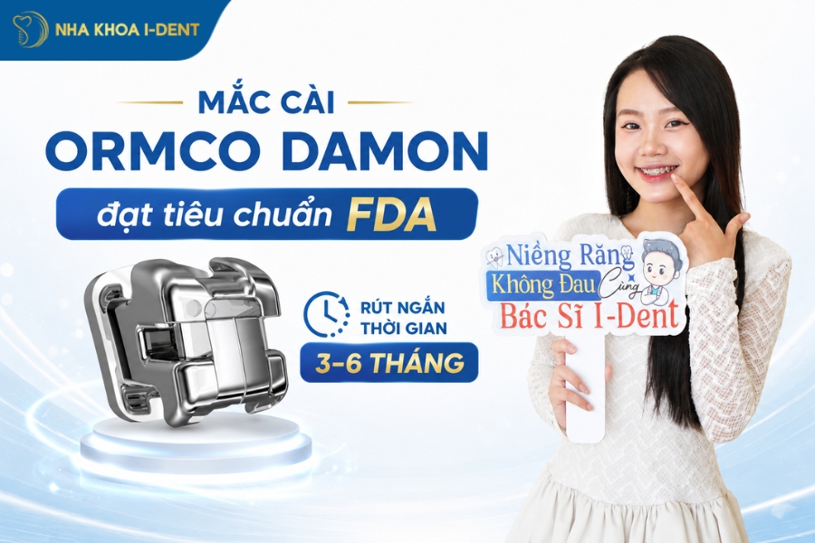 niềng răng khớp cắn ngược giá bao nhiêu - Nha khoa I-Dent