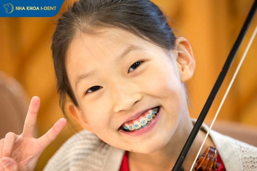 độ tuổi ảnh hưởng thời gian niềng