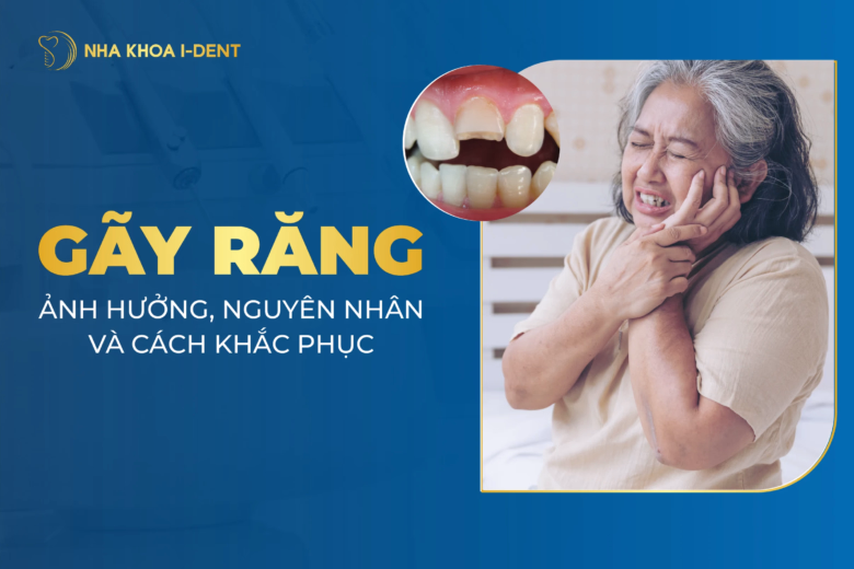 Gãy răng có sao không