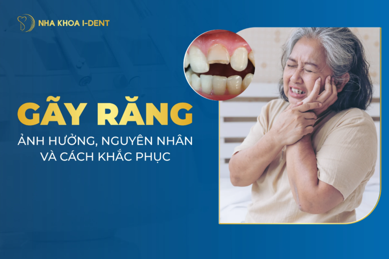 Gãy răng: Ảnh hưởng, nguyên nhân và cách khắc phục