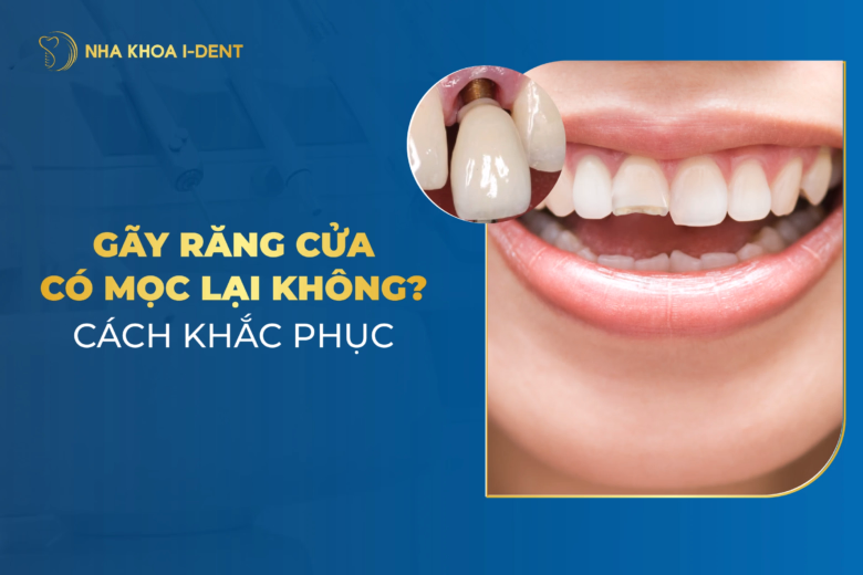 bị gãy răng cửa có mọc lại không