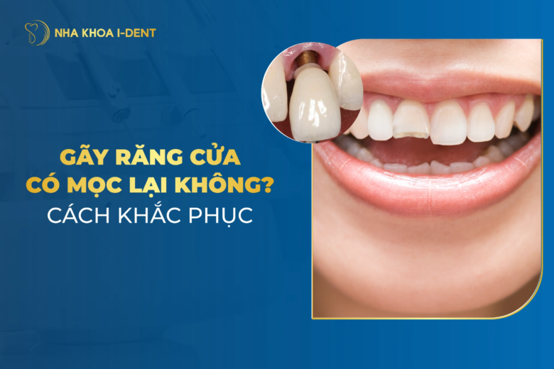 Gãy Răng Cửa Có Mọc Lại Không? Cách Khắc Phục