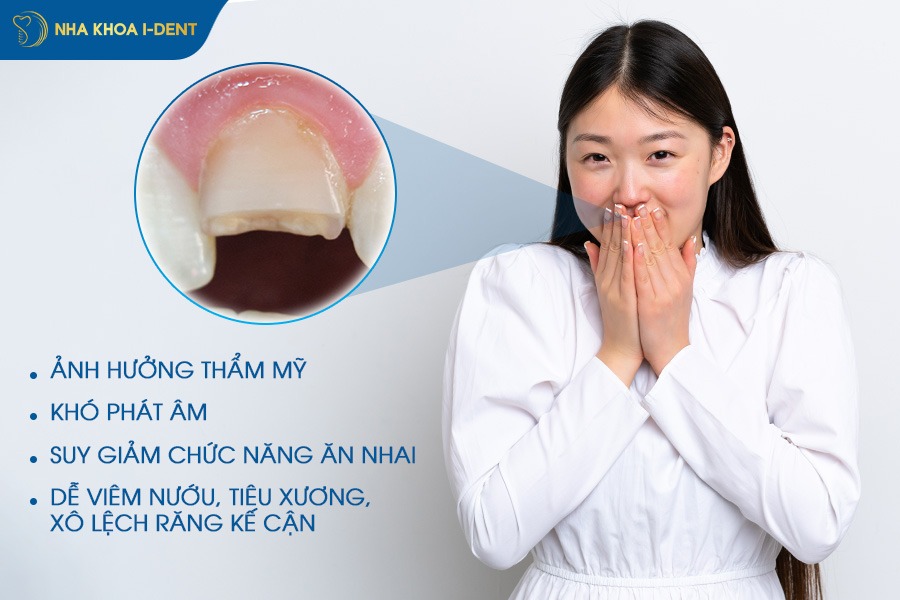 Gãy răng cửa tác động tiêu cực đến thẩm mỹ và tâm lý