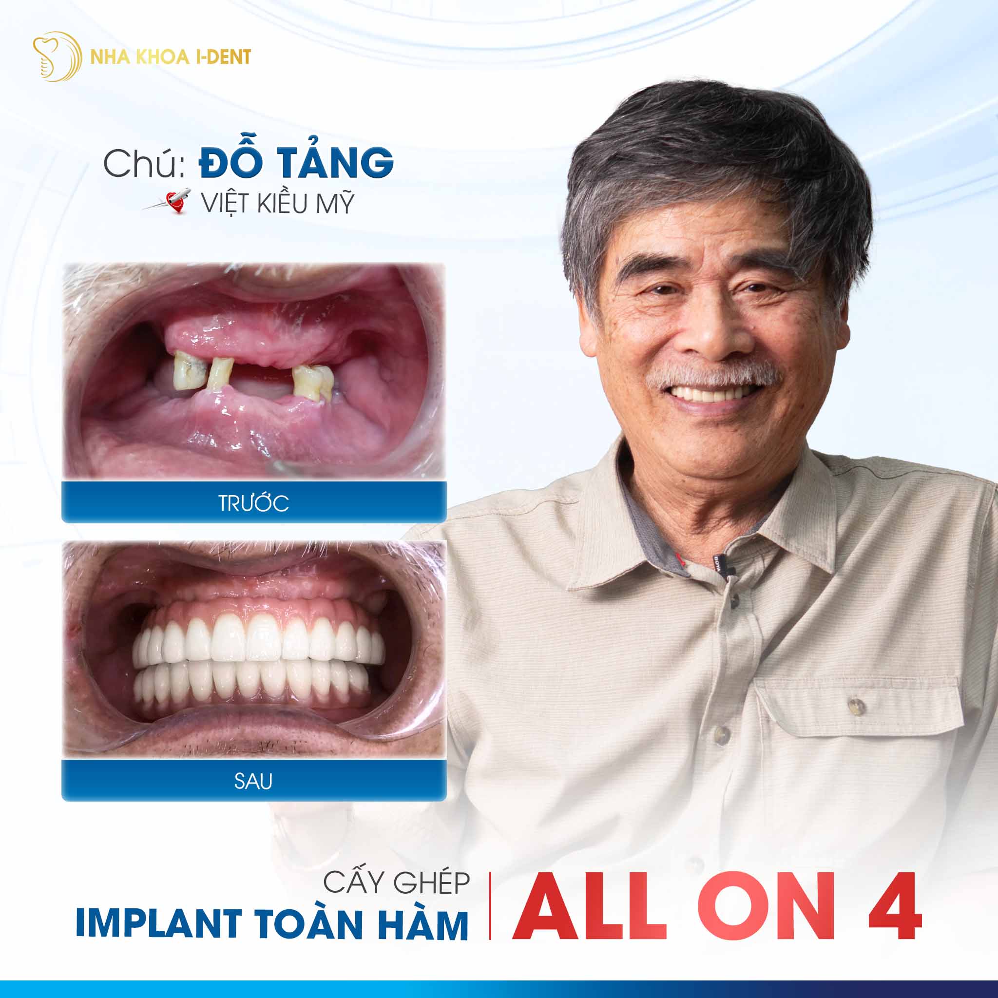 khách hàng trồng implant
