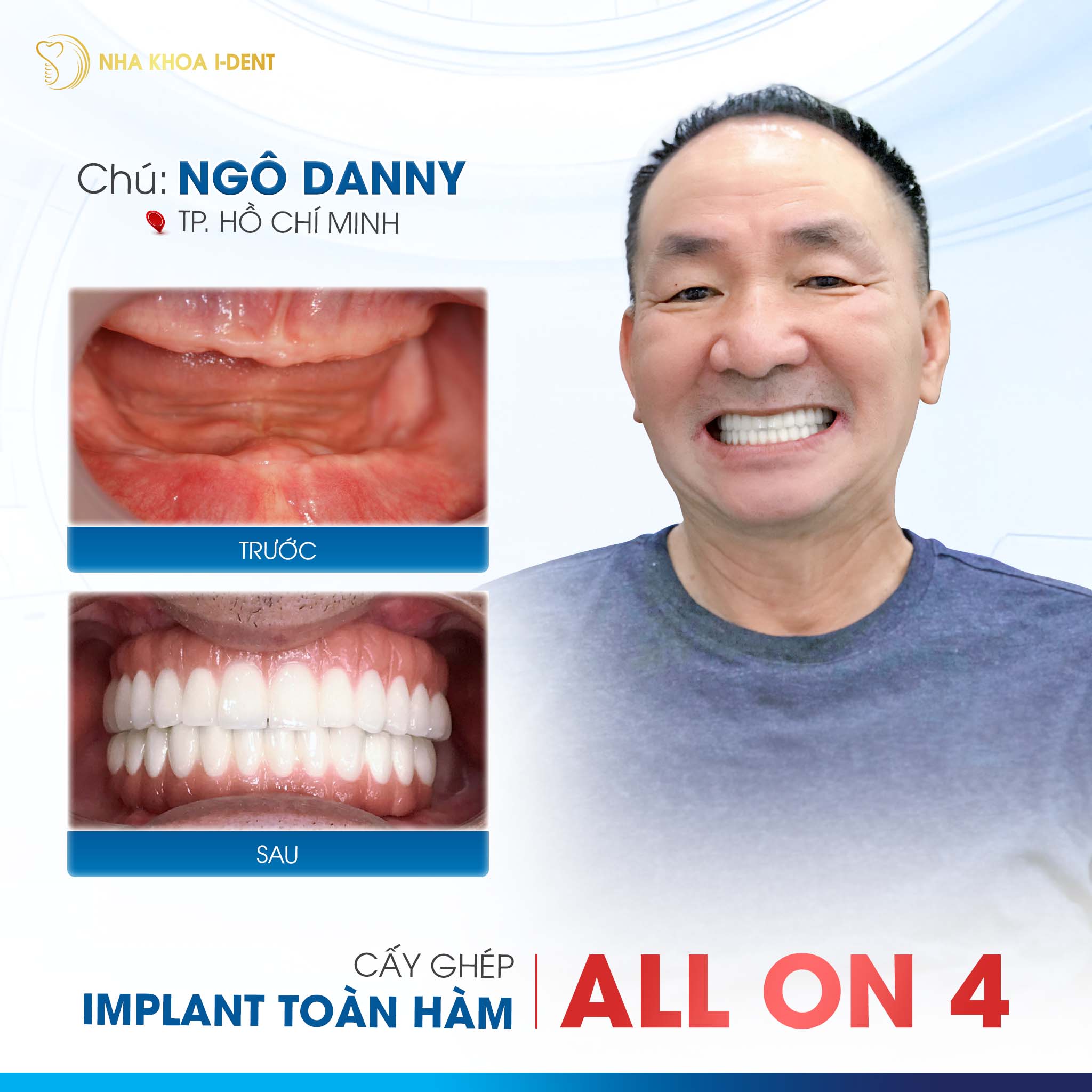 khách hàng làm implant