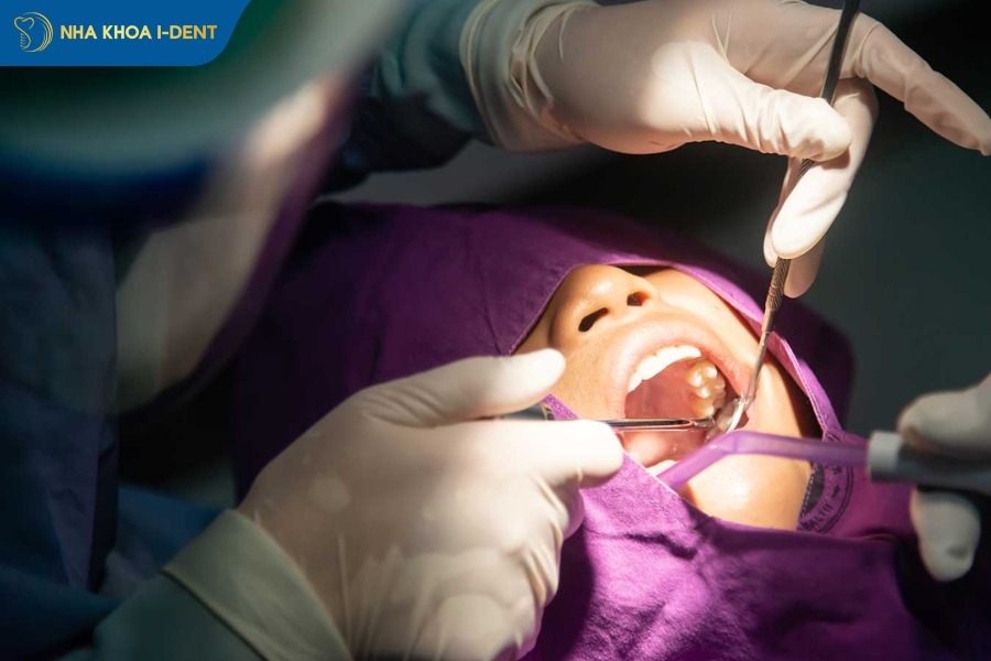 nhổ răng khôn trước khi niềng